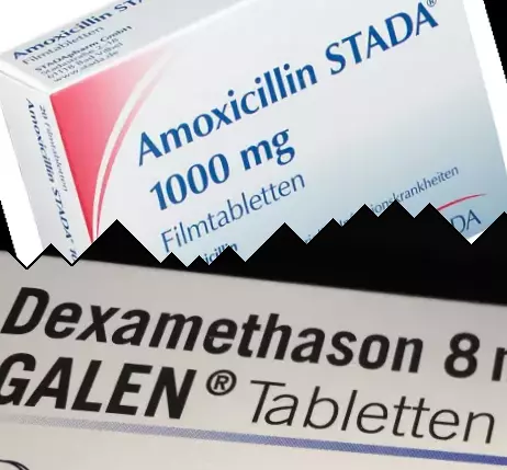 Amoxicillin vs Dexamethasone