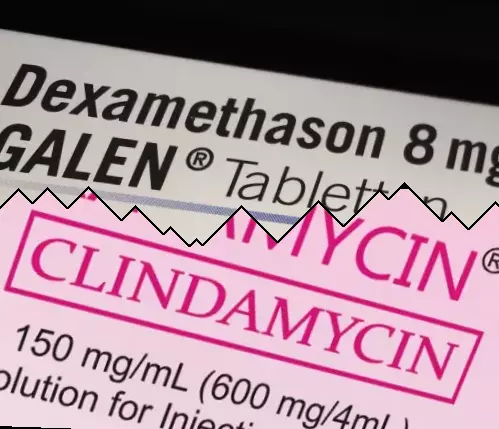 Dexamethasone vs Clindamycin